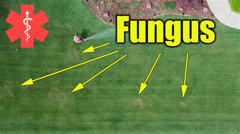 Lawn Fungus Treatment Lawn Care