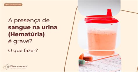 A presença de sangue na urina hematúria é grave O que fazer Dra