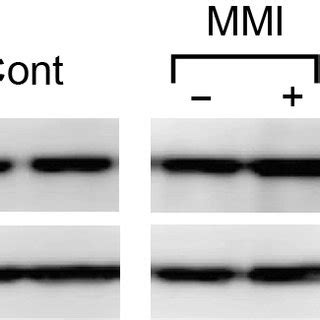 Dna Microarray Analysis Of Frtl Cells Treated With Anti Thyroid