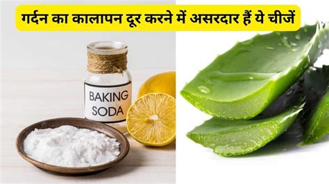 Is Aloe Vera Gel And Baking Soda Scrub Useful To Get Rid Of Dark Neck Know From Expert क्या