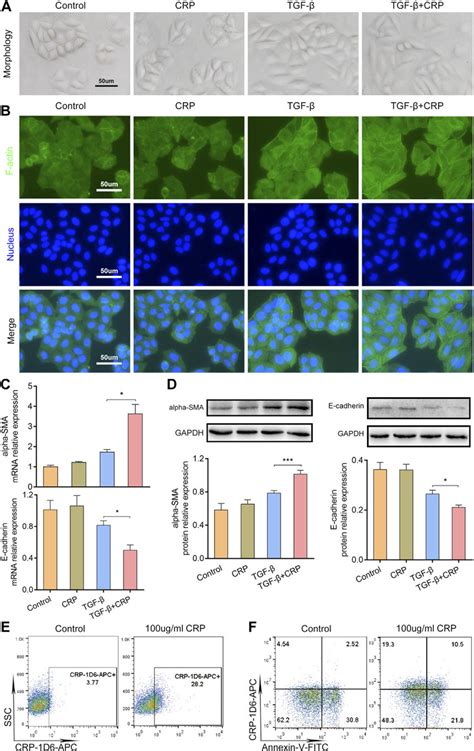 CRP Enhances TGF B Induced EMT In HK 2 Cells A Cellular Morphology