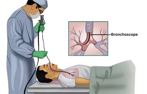 bronchoscopy universal hospital