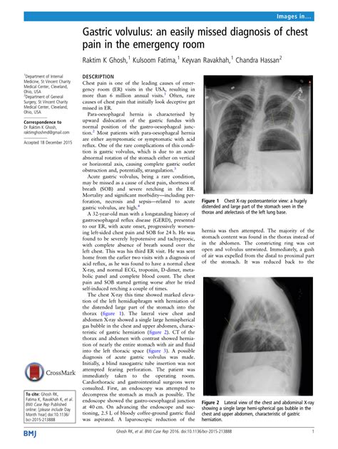 Gastric Volvulus Imaging And Diagnosis Practice Essentials Hot Sex