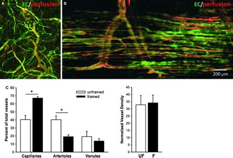 Architecture Of And Vessel Type Distribution In Microvascular Networks