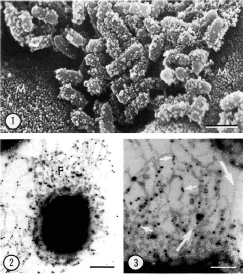 Transmission Electron Micrograph Of Negatively Stained Whole Mount Of