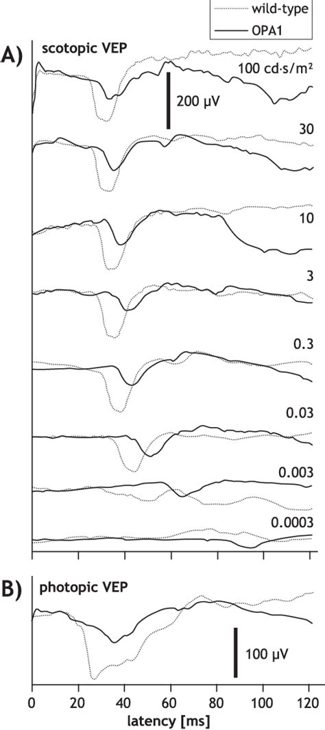 Figure 1 From Electrophysiological And Histologic Assessment Of Retinal