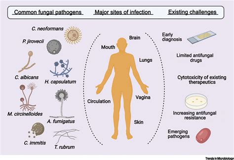 RNA-based therapeutics to treat human fungal infections: Trends in
