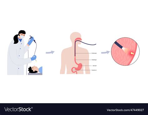 Gastroscopy Endoscopy Procedure Royalty Free Vector Image