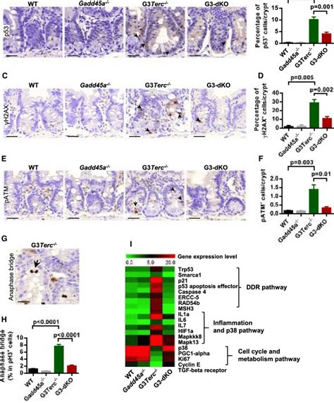 Gadd45a Deletion Attenuates Telomere Dysfunction Induced DDR In The