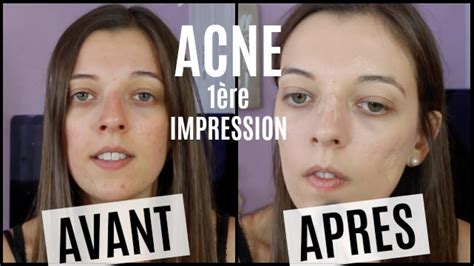 ACNE Une journée avec NAKED SKIN de URBAN DECAY test première