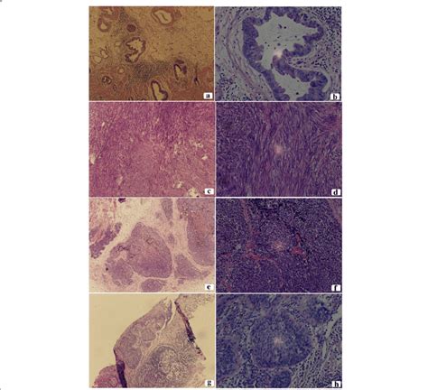 Photomicrograph Showing The Cytomorphological Finds Of The Surgical