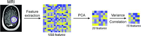 Schematic Of The Radiomic Feature Selection Process From The Extraction Download Scientific