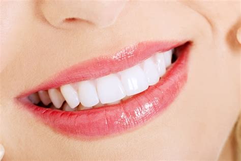 What is Teeth Bleaching? | Los Angeles Dentist | Free Consultations