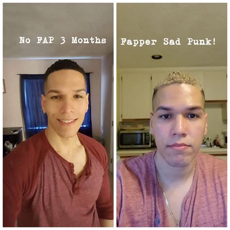 No Fap Benefits For Skin Online Offers | www.micoope.com.gt