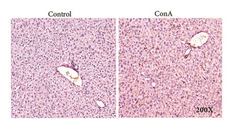 Morphological And Immunohistochemical Analysis Of Liver Tissues In Download Scientific Diagram