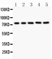 Anti Rip Ripk Antibody Picoband Bosterbio