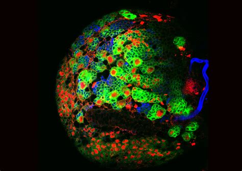 neural stem cell   age