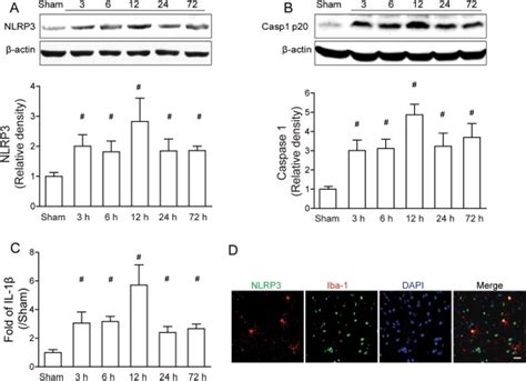 Expression Profile Of The Nlrp Inflammasome Components After