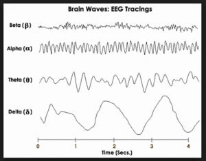 Brain Scan - BrainX Brain & Mind Centres