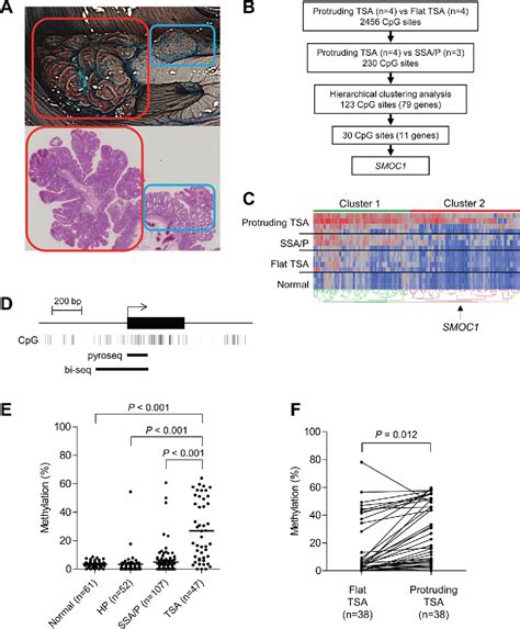 Figure From Epigenetic Silencing Of Smoc In Traditional Serrated