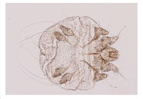 | Morphological features of Sarcoptes scabiei mites. | Download ...