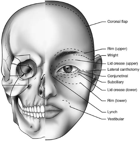 Orbital Apex Anatomy