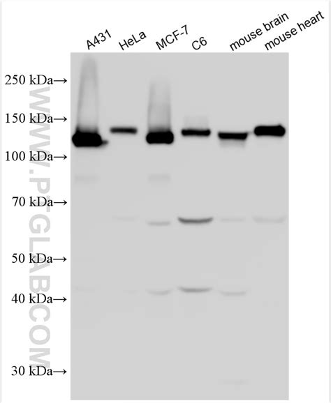 Pan Cadherin Antibody Ap Proteintech