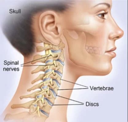 Why Does My Neck Hurt When I Turn It A Guide To Mechanical Neck Pain