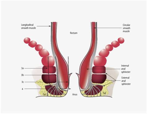 Botox Treatment for Anal Fissures Avrupa Cerrahi Tıp Merkezi