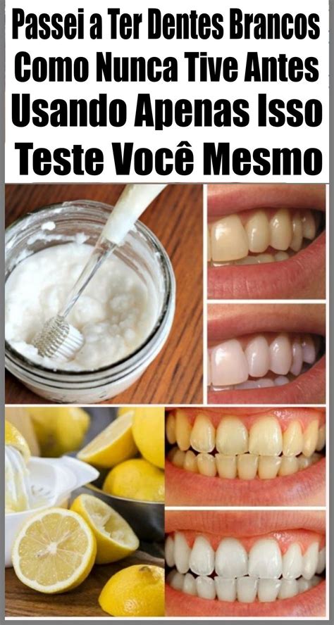 Aprenda Como Clarear Os Dentes Em Apenas Minutos Beauty Care Food