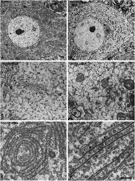 A B Electron Micrographs Of Motor Neurons From Control A And Download Scientific Diagram