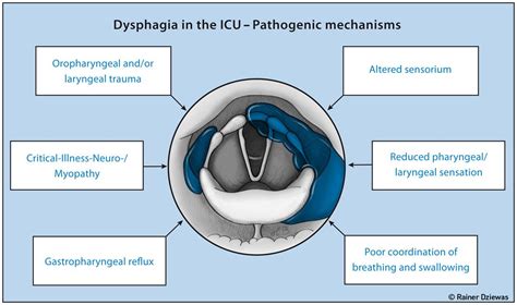 Oropharyngeal Dysphagia Causes