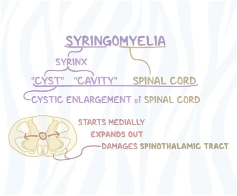 Syringomyelia