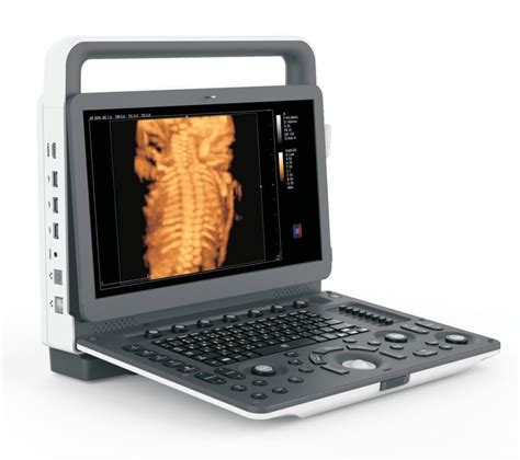 Portable Ultrasound – Kamed International