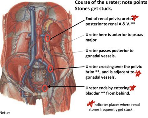 Imaging In Nephrology And Urology Flashcards Quizlet