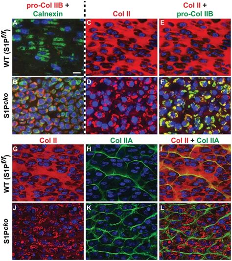 Double Labeled Immunofluorescence Analyses Were Done For Pro Col Iib Download Scientific