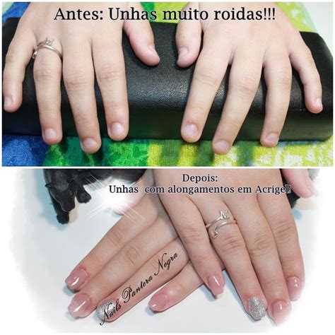 Antes Unhas Muito Roidas Depois Unhas Em Acrigel Em Cor Nude