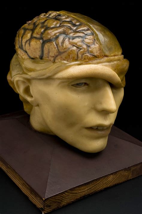 Art and science of the human brain (images) - CNET