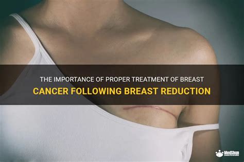 The Importance Of Proper Treatment Of Breast Cancer Following Breast