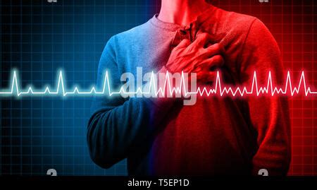 Crise cardiaque et une douleur de maladie cardiovasculaire médical