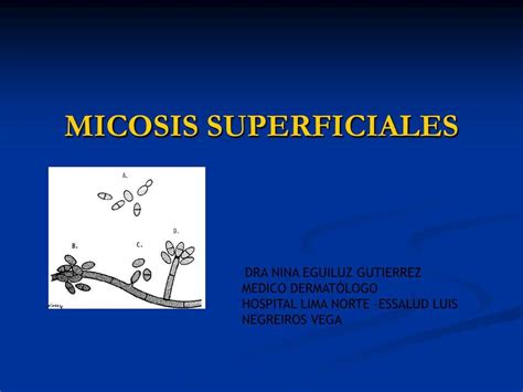 Micosis Superficiales Ahmed Casana Udocz