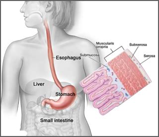 Metastatic Gastric Cancer | HER2 Positive Metastatic Breast Cancer ...