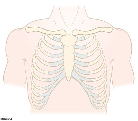 12 Lead EKG placement Diagram | Quizlet