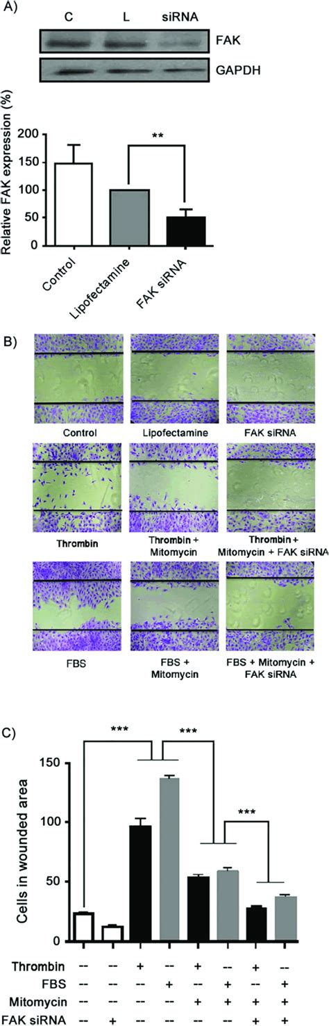 FAK expression is essential for thrombin induction of RPE cell ...