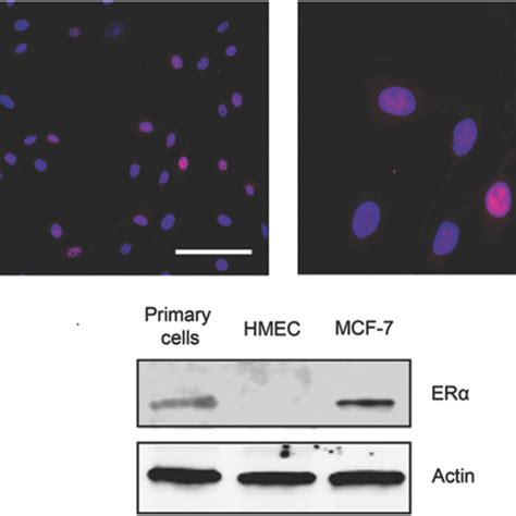 Expression of ERα in the cultured primary mammary epithelial cells A