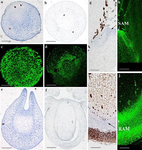 Localization Of Tcl1l Transcripts By In Situ Hybridization During