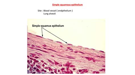 Solution Histology Epithelium Simple Squamous Epithelium Studypool