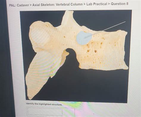 Solved PAL Cadaver Axial Skeleton Vertebral Column Lab Chegg