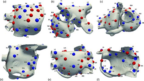 Atrial Model And Localization Of The Ectopic Foci Localization Of The