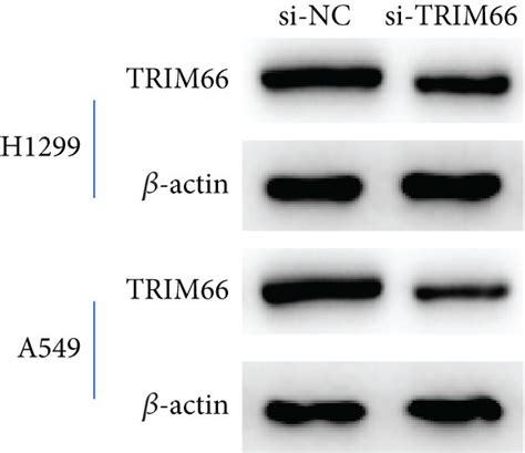 Trim Knockdown Inhibits The Migration And Invasion Of Nsclc Cells And